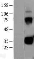 Kallikrein 1 (KLK1) Human Over-expression Lysate