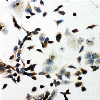Anti-VEGF Receptor 2/KDR Antibody