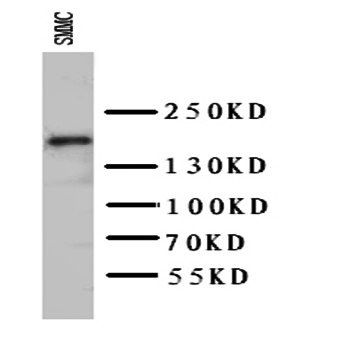 VEGF Receptor 2/KDR Antibody