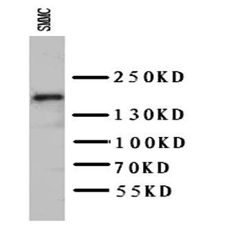 Anti-VEGF Receptor 2/KDR Antibody