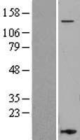 CD11a (ITGAL) Human Over-expression Lysate
