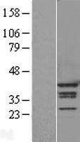 hnRNP A1 (HNRNPA1) Human Over-expression Lysate
