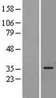 Heme Oxygenase 1 (HMOX1) Human Over-expression Lysate