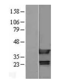 HMG1 (HMGB1) Human Over-expression Lysate