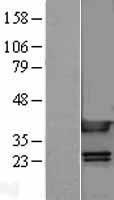 HMG1 (HMGB1) Human Over-expression Lysate