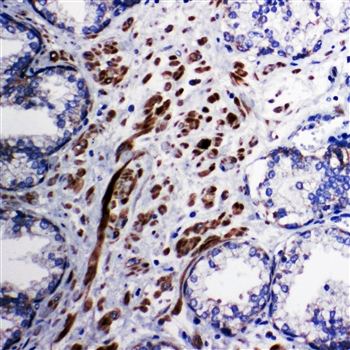 Anti-Mitochondrial Pyruvate dehydrogenase kinase 1/PDK1 Antibody