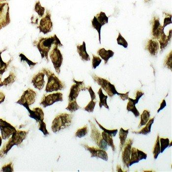 Anti-PDK2 Antibody