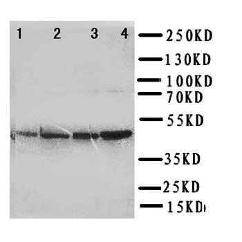 Anti-PDK2 Antibody