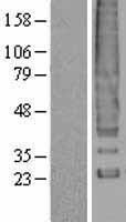 DARC (ACKR1) Human Over-expression Lysate
