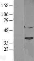 Cathepsin L (CTSL) Human Over-expression Lysate