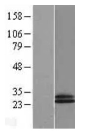 CD69 Human Over-expression Lysate