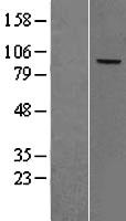 Complement factor B (CFB) Human Over-expression Lysate