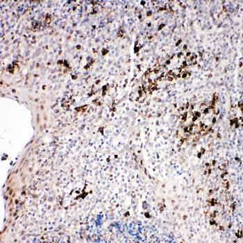 Anti-TRAF2 Antibody