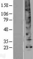 Aquaporin 5 (AQP5) Human Over-expression Lysate