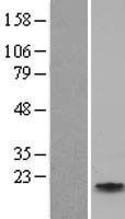 Apolipoprotein CIV (APOC4) Human Over-expression Lysate
