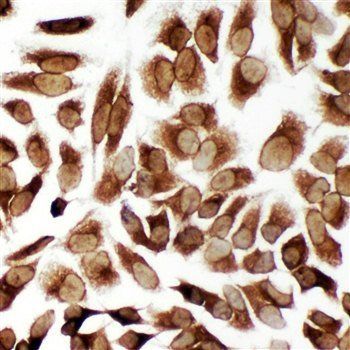 Anti-TRAM1 Antibody