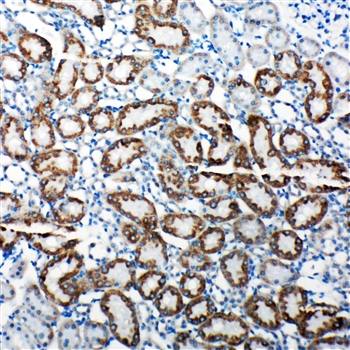 Anti-TRAM1 Antibody