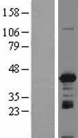 IGBP1 Human Over-expression Lysate
