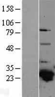 GSTA4 Human Over-expression Lysate
