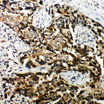 Anti-Hamartin/TSC1 Antibody