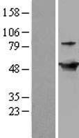 GDI2 Human Over-expression Lysate