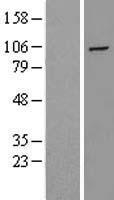 HIF 2 alpha (EPAS1) Human Over-expression Lysate