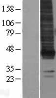 EDG2 (LPAR1) Human Over-expression Lysate