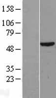 DKC1 Human Over-expression Lysate