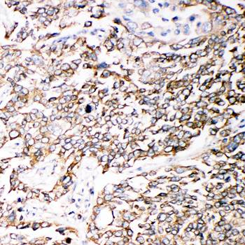 Anti-PMP70/ABCD3 Antibody