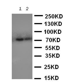 Anti-PMP70/ABCD3 Antibody