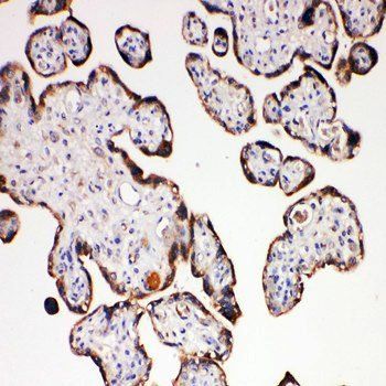 Aquaporin 6/AQP6 Antibody