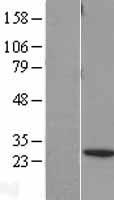 BNIP1 Human Over-expression Lysate