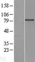 AOC2 Human Over-expression Lysate