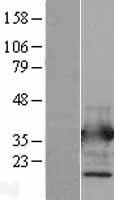 Annexin V (ANXA5) Human Over-expression Lysate