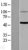 UGT1A6 Human Over-expression Lysate