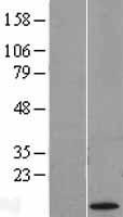 KK LC 1 (CT83) Human Over-expression Lysate