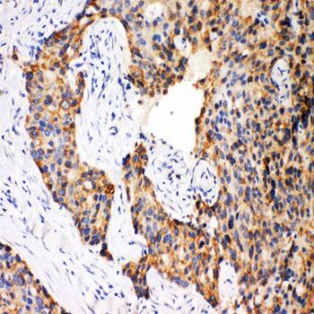 Anti-Caspase-12/CASP12 Antibody