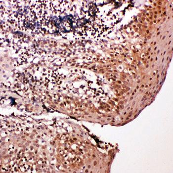 Anti-Caspase-14/CASP14 Antibody