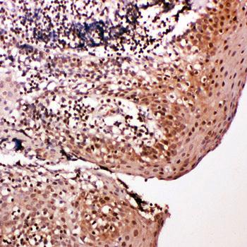 Caspase-14/CASP14 Antibody