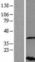 VHLL Human Over-expression Lysate