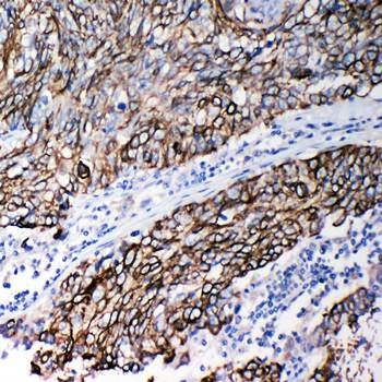 Anti-Stefin B/CSTB Antibody