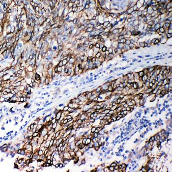 Stefin B/CSTB Antibody