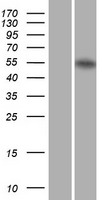 Retinoic Acid Receptor alpha (RARA) Human Over-expression Lysate