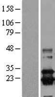 Prostaglandin D Synthase (PTGDS) Human Over-expression Lysate