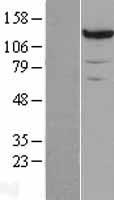 PCB (PC) Human Over-expression Lysate