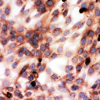Anti-Gelsolin/GSN Antibody