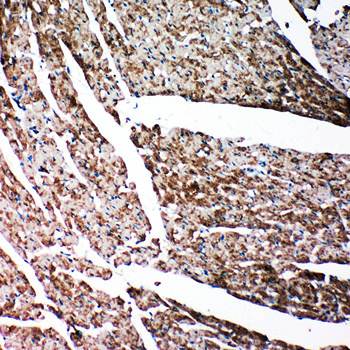 Anti-Gelsolin/GSN Antibody