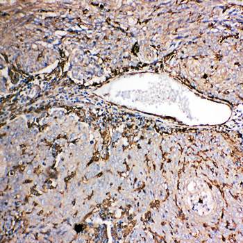 Anti-Gelsolin/GSN Antibody