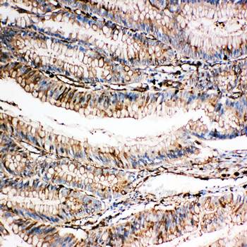 Anti-Gelsolin/GSN Antibody