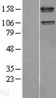 IGF1 Receptor (IGF1R) Human Over-expression Lysate